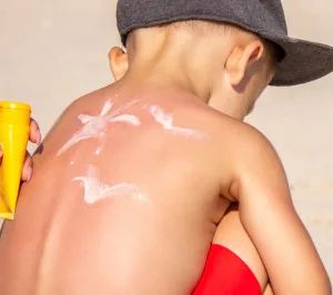 CREMA SOLAR EN NIÑOS